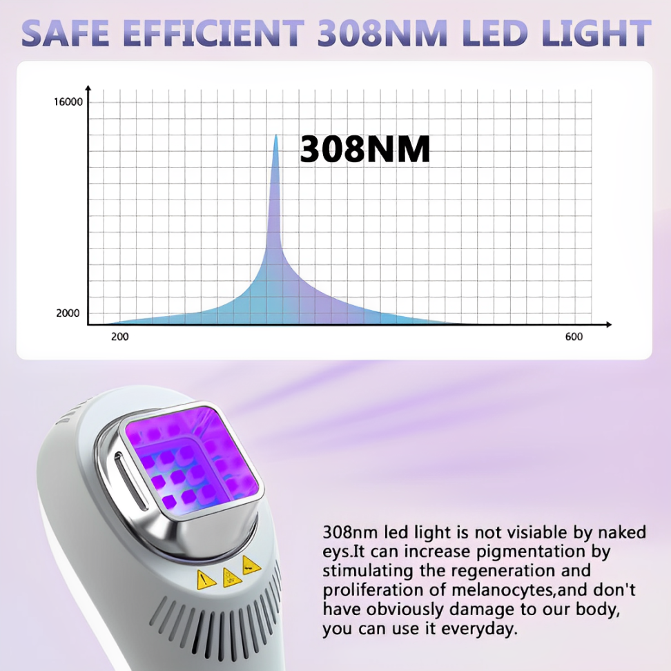 VitaLuma 308nm UVB Vitiligo Phototherapy Lamp for Home Use - OpalDwell
