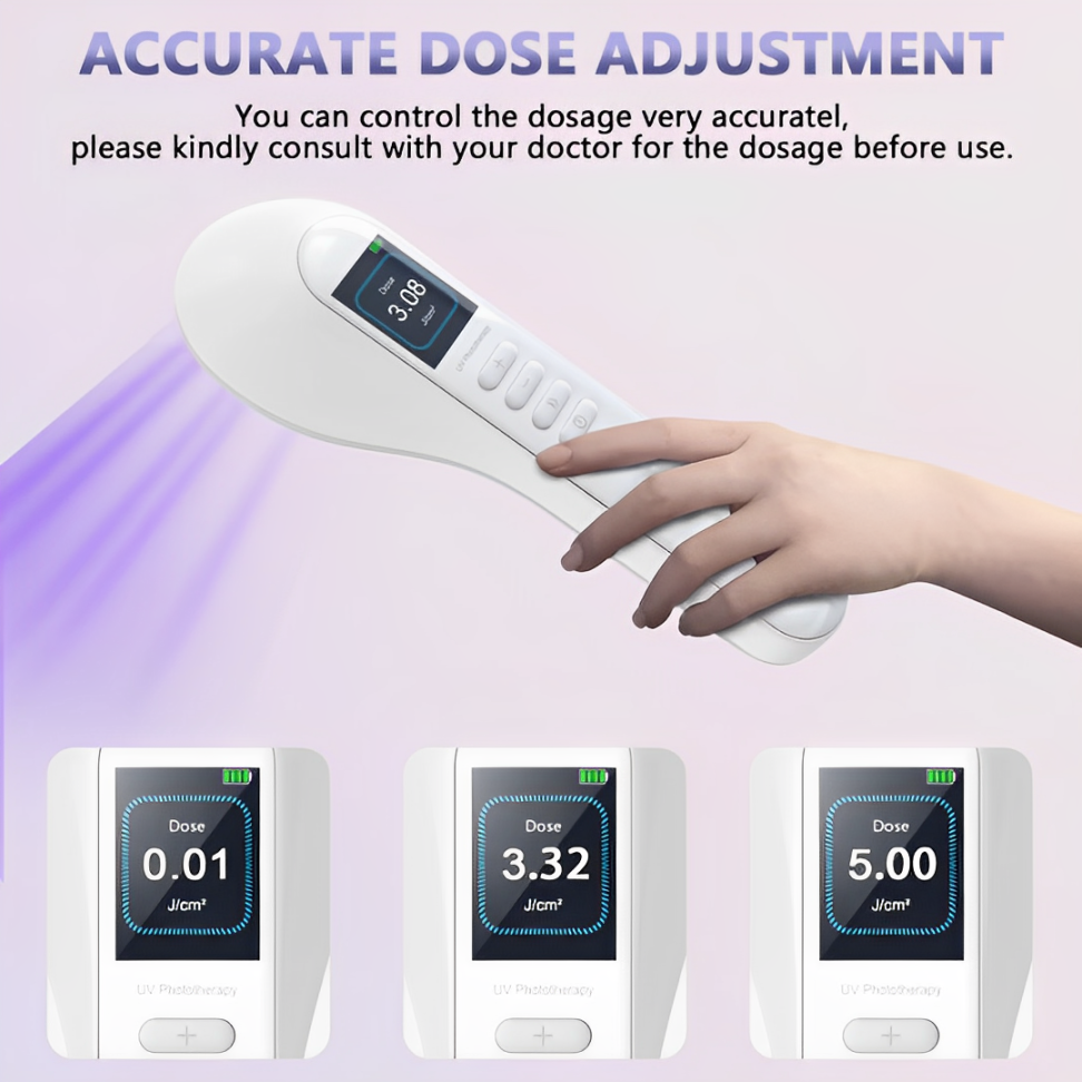 VitaLuma 308nm UVB Vitiligo Phototherapy Lamp for Home Use - OpalDwell