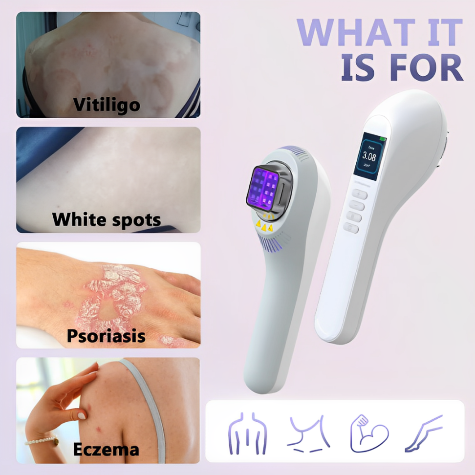 NovaRay UVB 308nm Home Phototherapy Lamp For Vitiligo And Skin Wellness - OpalDwell