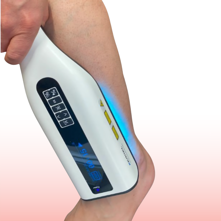 DermaLuma Portable UVB Therapy Lamp for Psoriasis and Vitiligo at Home - OpalDwell