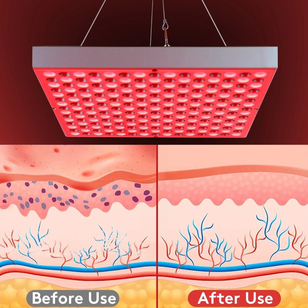SolaraLift Red Light Therapy Lamp for Sleep Recovery Pain Relief Skin Health - OpalDwell