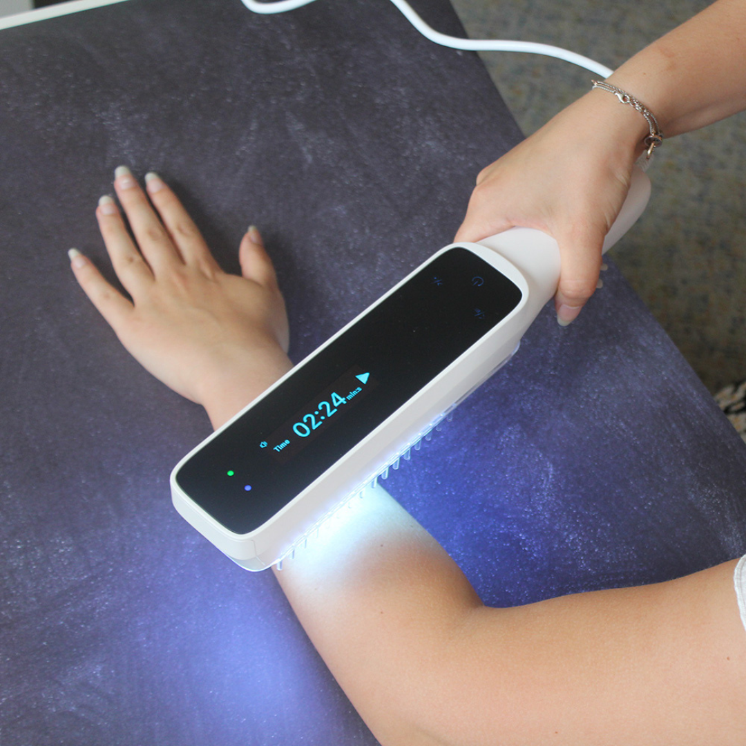 AureaPulse Handheld UVB Narrowband Phototherapy Lamp Timer And Touch Control - OpalDwell
