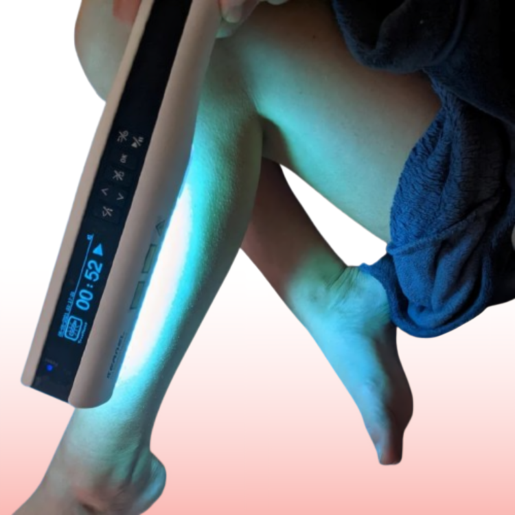 Lumara Pocket UVB Light Therapy Lamp 311nm For Psoriasis And Vitiligo - OpalDwell
